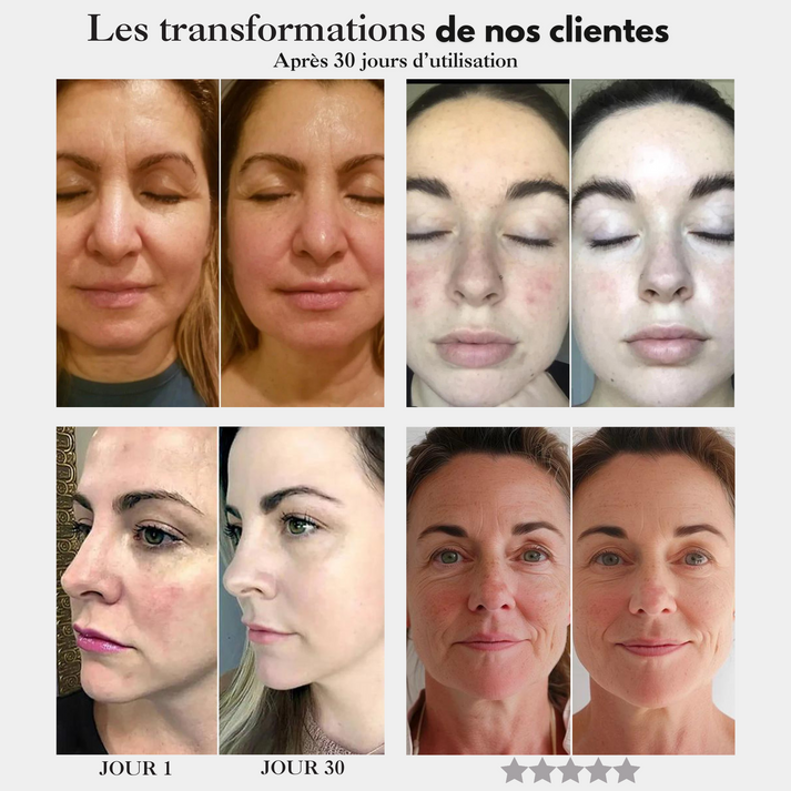 Sculpteur visage et cou – Lift, raffermit et rajeunit instantanément