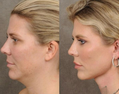 Sculpteur visage et cou – Lift, raffermit et rajeunit instantanément